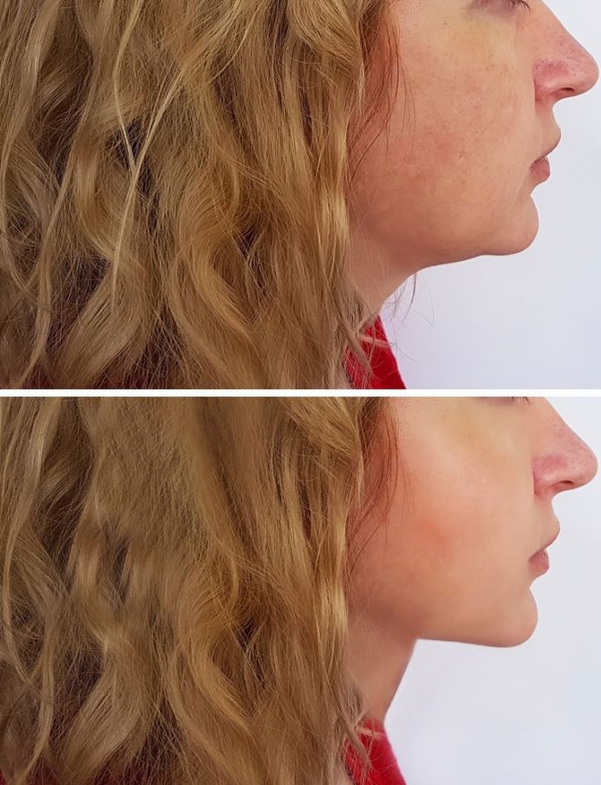 10 Fantastic Self-Care Tips You Must Adopt In Life